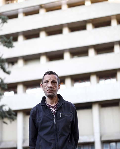 Türkiye'de ilk yüz nakli yapılan Uğur Acar yeni yüzüyle mutlu - 7