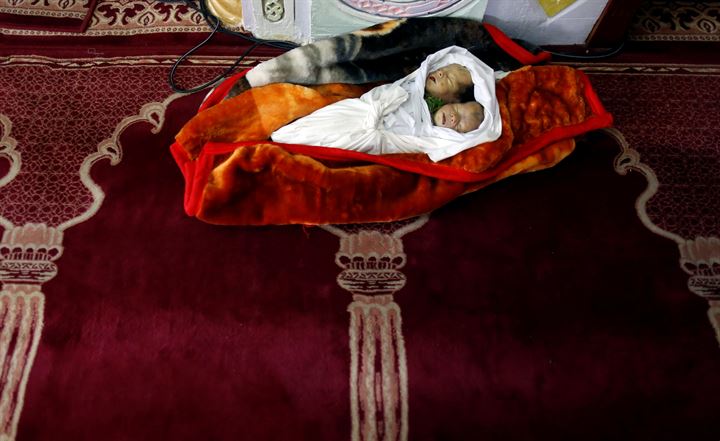 Yemende yeni doğan yapışık ikizler hayatını kaybetti - 6