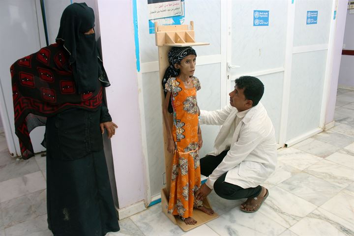 12 yaşında olan Fatima 10 kiloya kadar düştü - 3