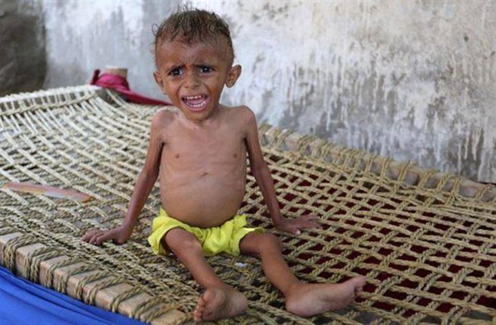 12 yaşında olan Fatima 10 kiloya kadar düştü - 9