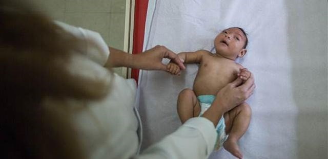 Zika virüsü Türkiye'de - 2