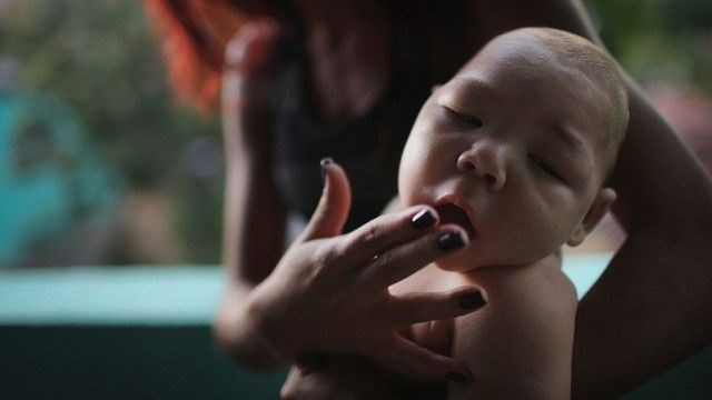 Zika virüsü Türkiye'de - 1