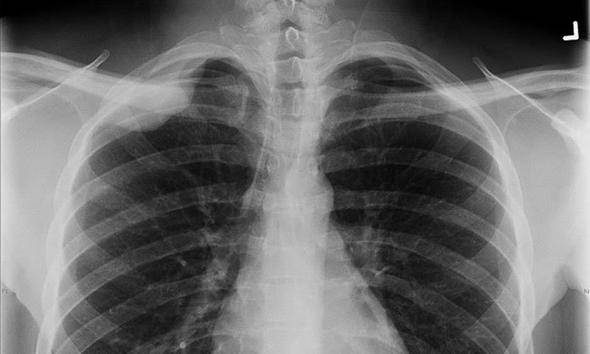 Dünyanın en ilginç buluşları - 60