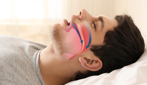 25 soruda beyin yaşınızı öğrenin - 21