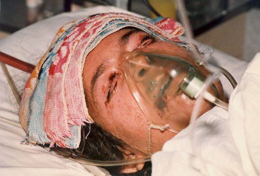 Halepçe Katliamının 31.yılı - 11