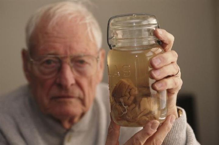 Einstein'ın beynini 240 parçaya böldü - 12