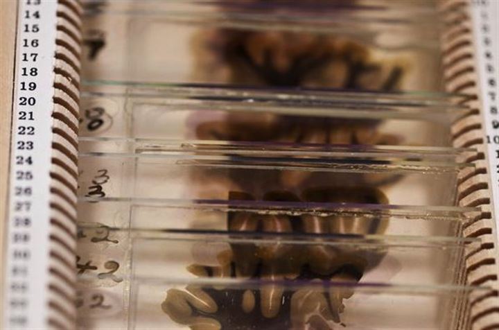 Einstein'ın beynini 240 parçaya böldü - 17