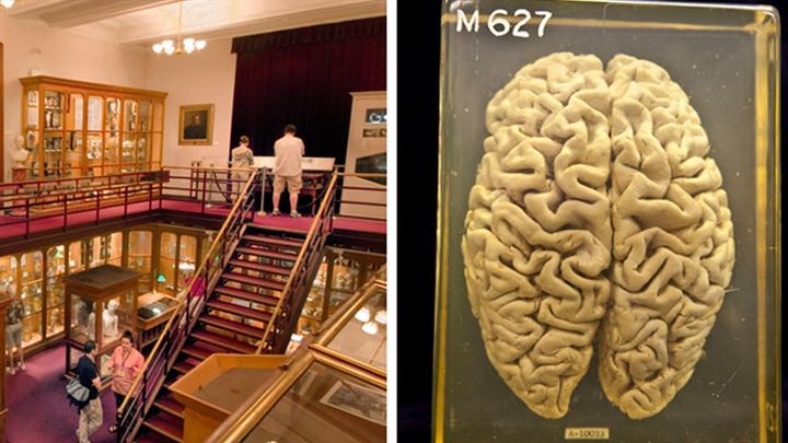 Einstein'ın beynini 240 parçaya böldü - 18