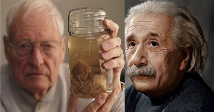 Einstein'ın beynini 240 parçaya böldü - 22