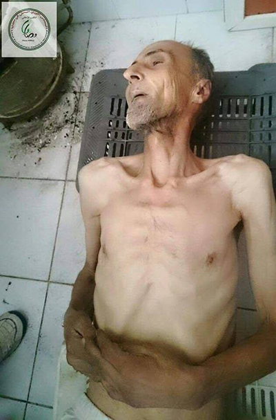 Madaya'da yaşanan insani kriz - 1