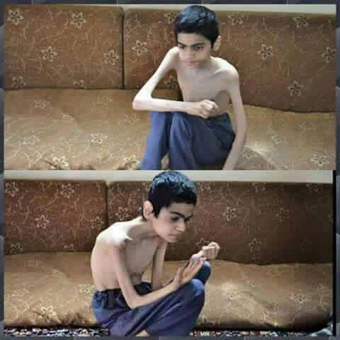 Madaya'da yaşanan insani kriz - 9