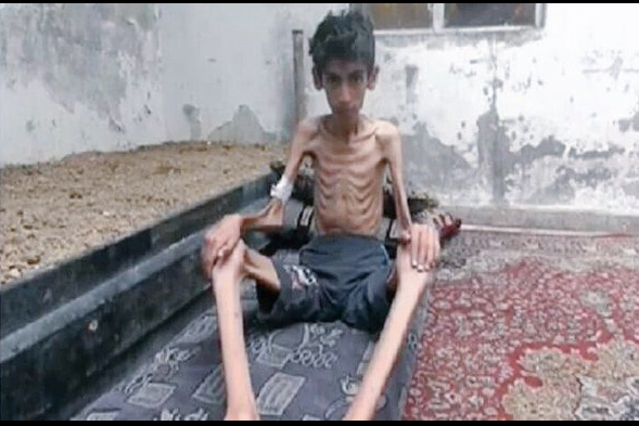 Madaya'da yaşanan insani kriz - 6