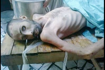 Madaya'da yaşanan insani kriz - 8