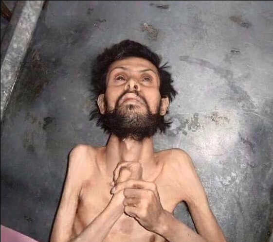 Madaya'da yaşanan insani kriz - 10