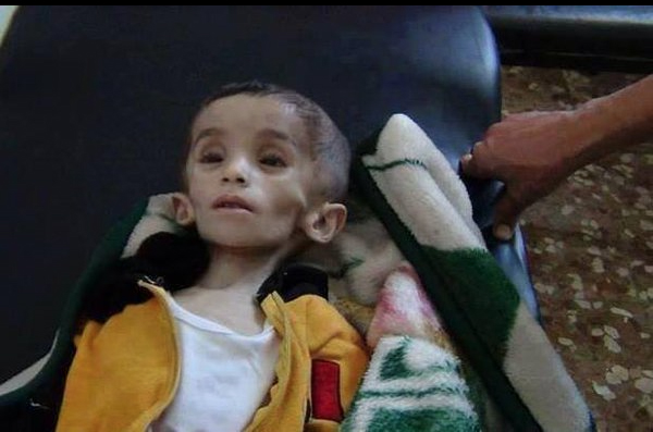 Madaya'da yaşanan insani kriz - 7