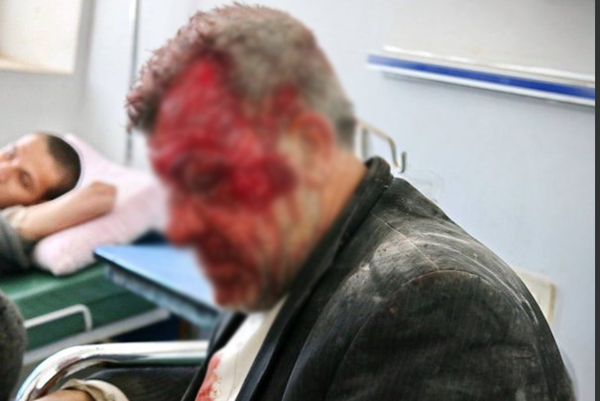 Rus savaş uçakları İdlib'e saldırdı: 47 ölü - 2