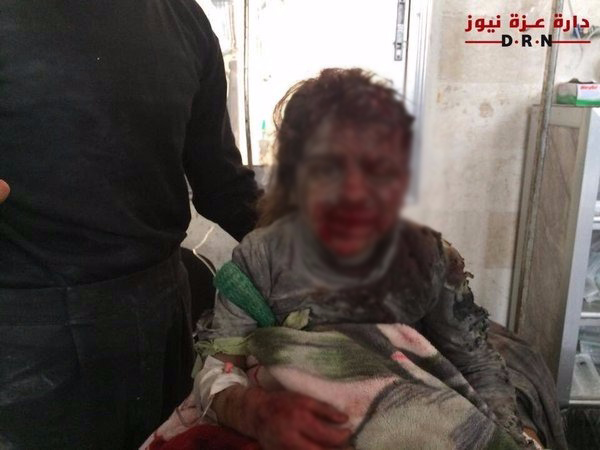 Rus jetleri Halep'te katliam yaptı: 17 ölü - 4