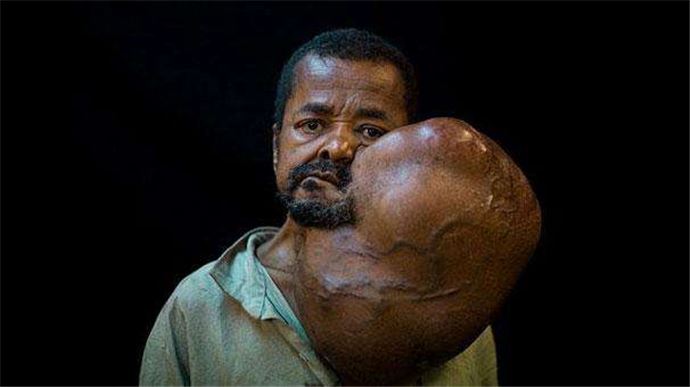 İlginç tıp olayları - 8