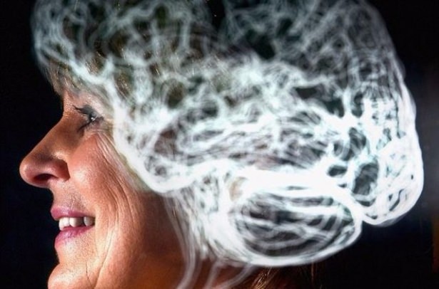 Beyin hakkında şaşırtıcı gerçekler - 15