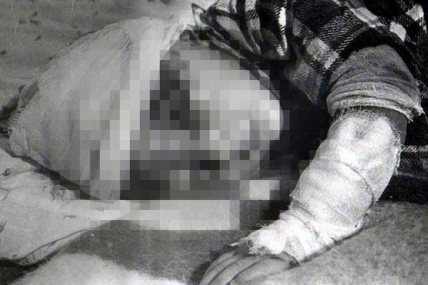 Hocalı katliamı'nın 24.yılı - 5