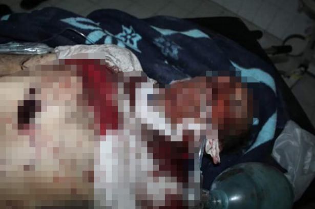 Rusya ve Esed İdlib’de pazar yerini vurdu - 568