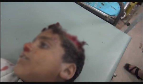 Halep'te katliam devam ediyor - 3