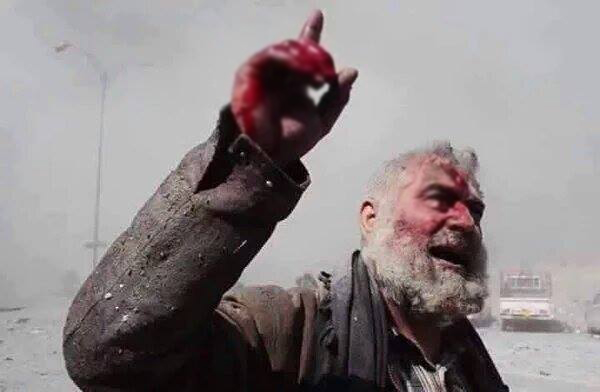 Halep'te katliam devam ediyor - 4