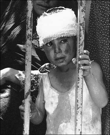 Yakın tarihin en büyük insanlık trajedilerinden biri: İran-Irak Savaşı - 64