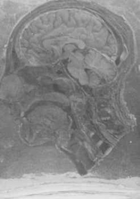 2.Dünya Savaşı'nın bilinmeyenleri - 36