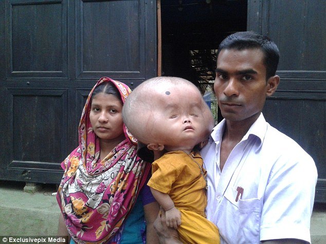 Minik çocuğun kafası tam 9 kilo ağırlığında - 2