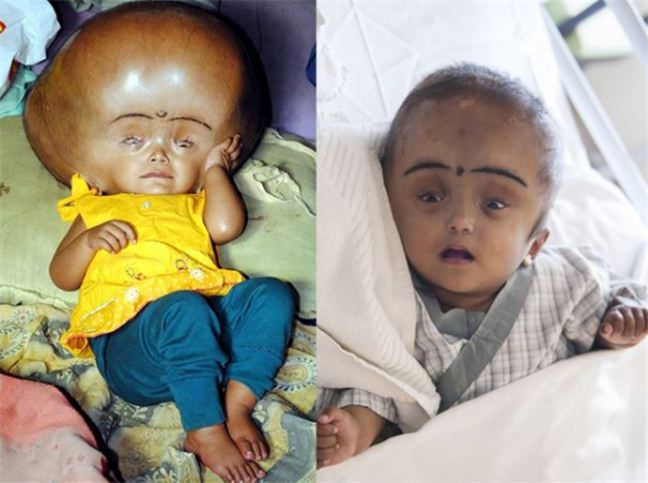 Minik çocuğun kafası tam 9 kilo ağırlığında - 4