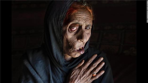 Afganistan'da savaşın izi silinemiyor - 3