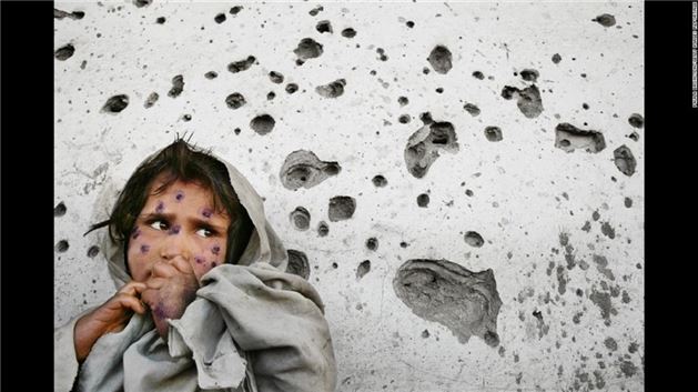 Afganistan'da savaşın izi silinemiyor - 6