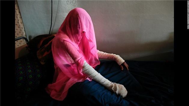 Afganistan'da savaşın izi silinemiyor - 7