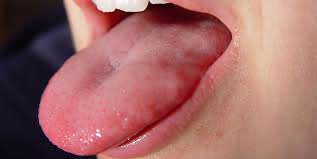 Az bilinen bilimsel gerçekler - 17