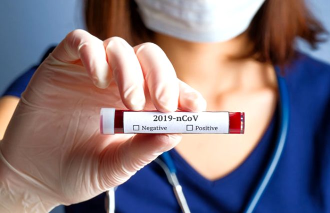 Koronavirüs kışın daha fazla mı artacak? - 3