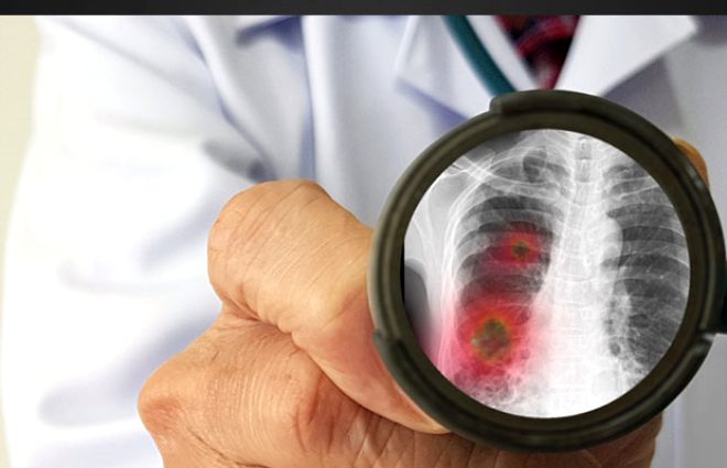 Koronavirüs kışın daha fazla mı artacak? - 6