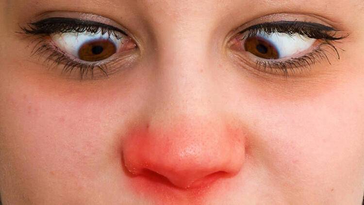 Yapınca anında değişiyor… Burundaki soğukluk ortaya çıkardı - 84791