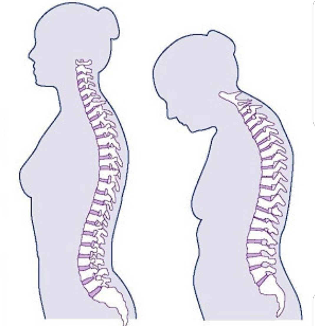 Omurga problemleri yaşamamak için bu kurallara dikkat edin! - 1