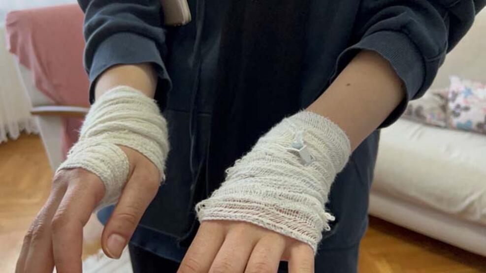 Tatil sırasında tacize uğrayan genç kız, öldüresiye dövüldü - 1