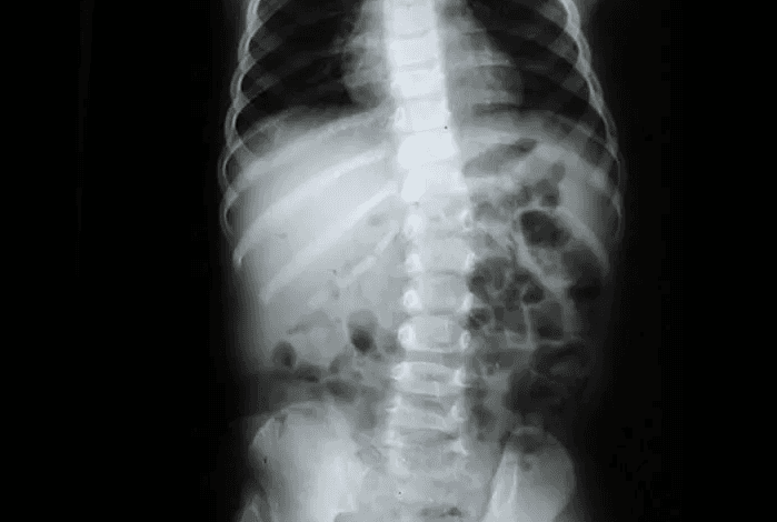 Prof. Özateş: Aşırı cep telefonu kullanımı kemik yapısını bozuyor - 3