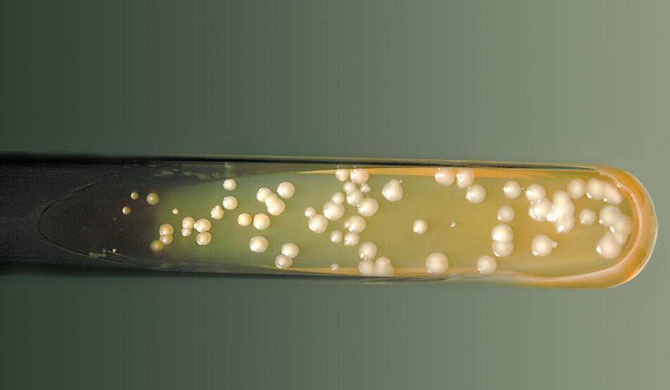 DSÖ'den uyarı! Dünyayı bekleyen yeni tehdit açıklandı: Öldürücü mantarlar! - 4