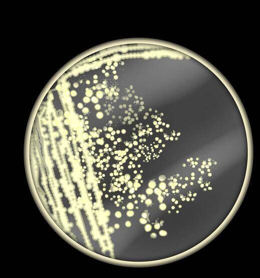 DSÖ'den uyarı! Dünyayı bekleyen yeni tehdit açıklandı: Öldürücü mantarlar! - 8