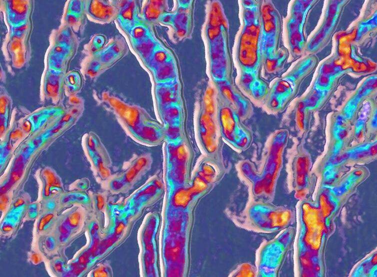 DSÖ'den uyarı! Dünyayı bekleyen yeni tehdit açıklandı: Öldürücü mantarlar! - 2