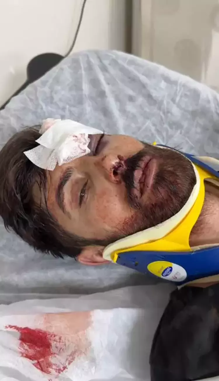 Antalya'da şiddet olayı: Çiçekçi, saldırıda komaya girdi - 3