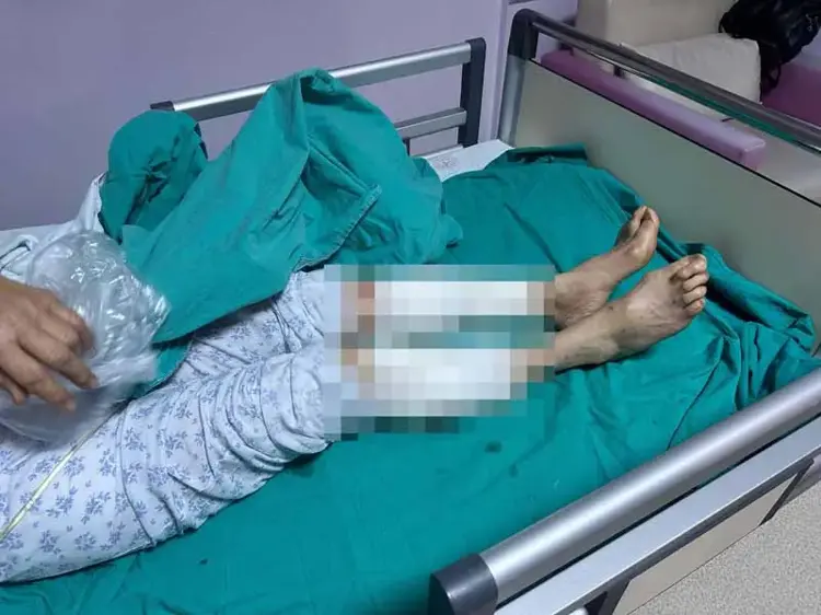 Tunceli'de köpek dehşeti: 65 yaşındaki kadın ölümden döndü - 2