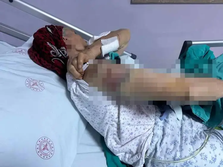 Tunceli'de köpek dehşeti: 65 yaşındaki kadın ölümden döndü - 1