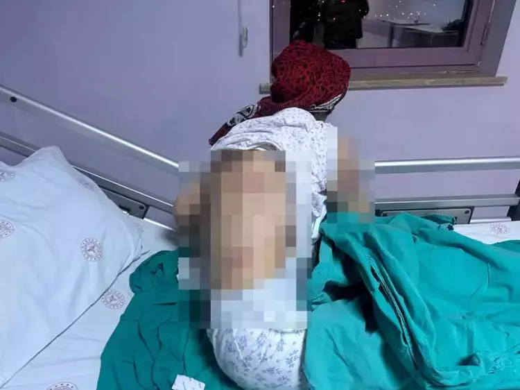 Tunceli'de köpek dehşeti: 65 yaşındaki kadın ölümden döndü - 4