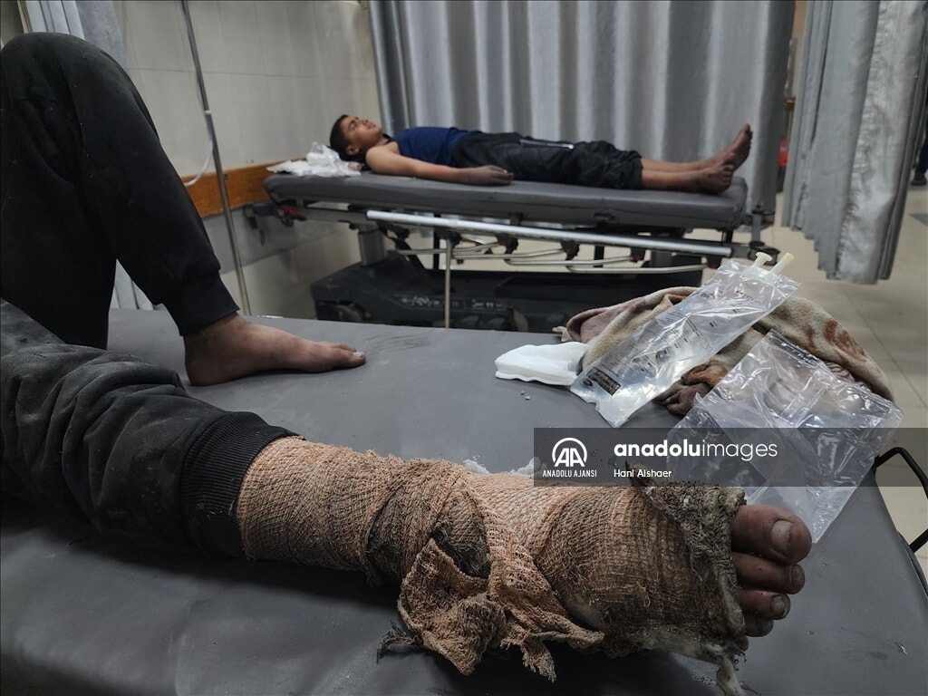 İsrail Gazze'de çadırları vurdu: Ölü ve yaralılar arasında çocuklar da var - 4