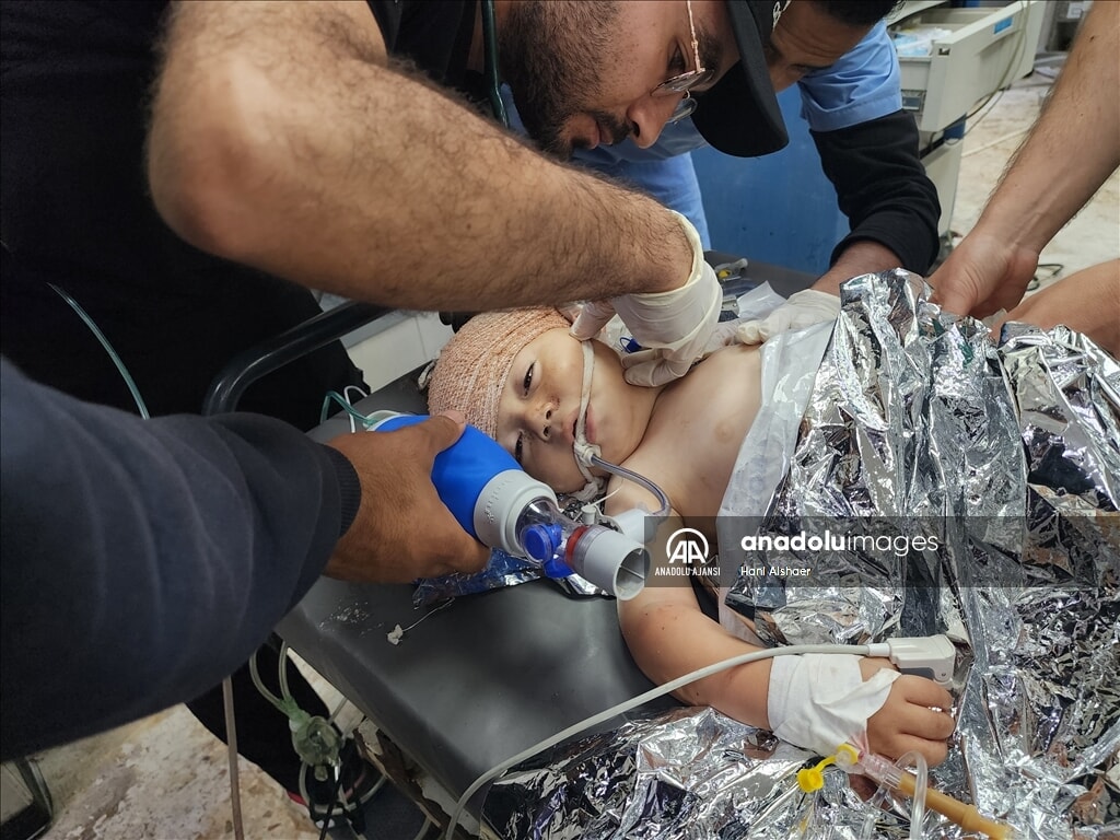 İsrail Gazze'de çadırları vurdu: Ölü ve yaralılar arasında çocuklar da var - 5